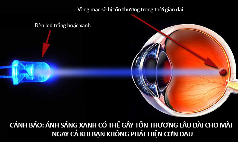 ánh sáng xanh ảnh hưởng mắt